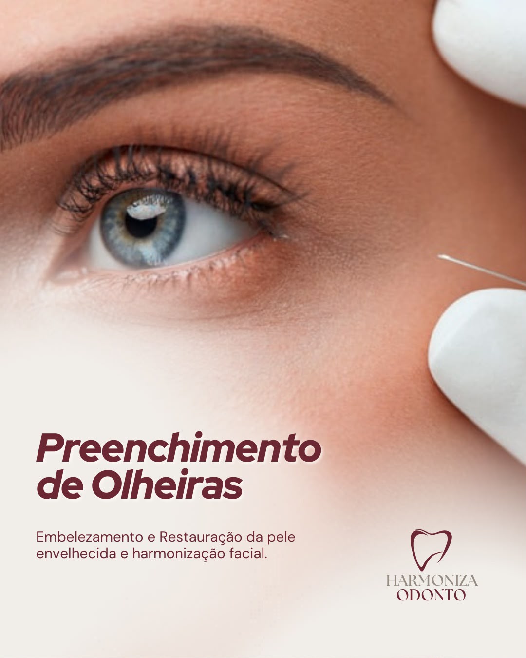 Preenchimento de Olheiras