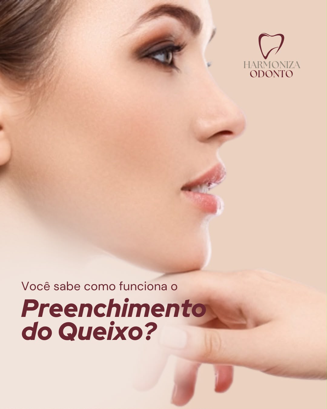 Preenchimento do Queixo