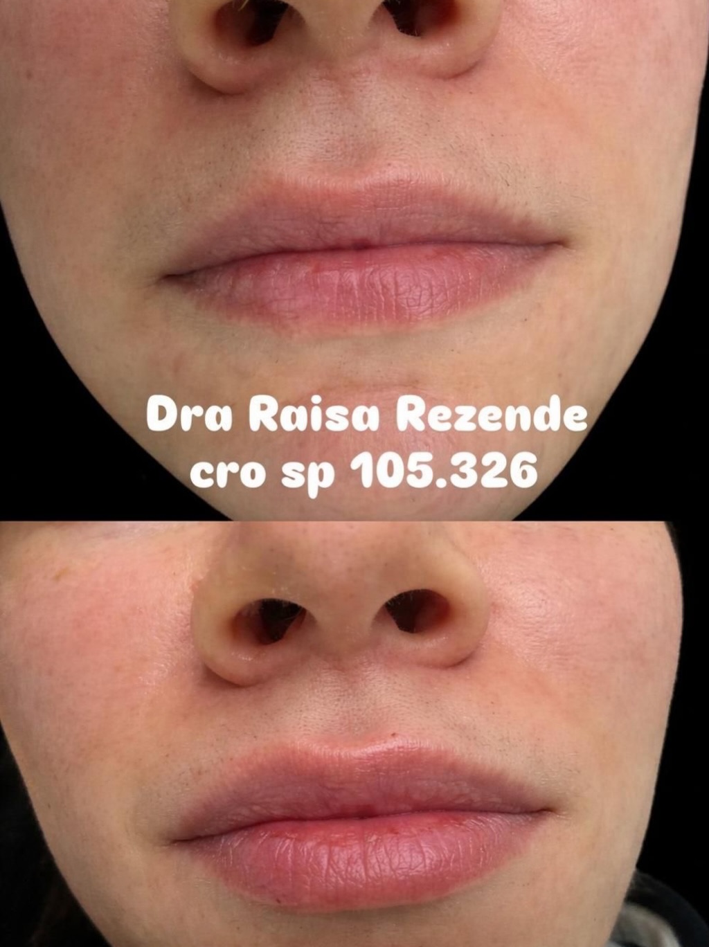Antes e depois